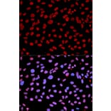 Anti-IFIH1 Antibody from Bioworld Technology (BS6939) - Antibodies.com