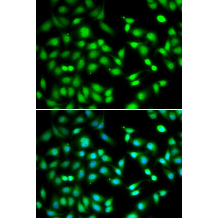 Anti-CDKN2D Antibody from Bioworld Technology (BS6940) - Antibodies.com