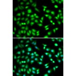 Anti-CDKN2D Antibody from Bioworld Technology (BS6940) - Antibodies.com