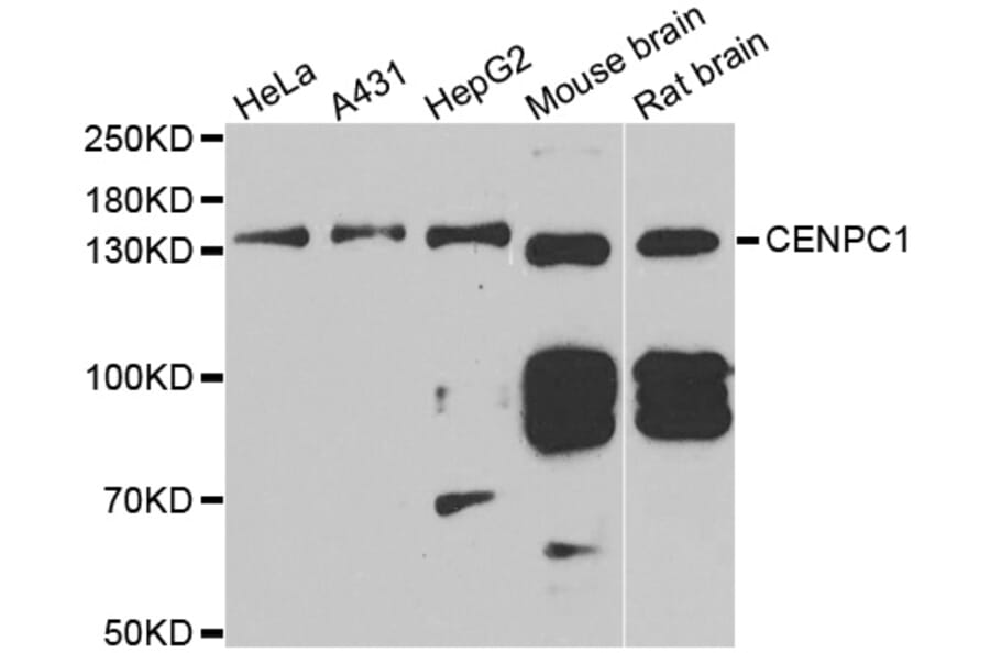Anti-CENPC1 Antibody from Bioworld Technology (BS6941) - Antibodies.com