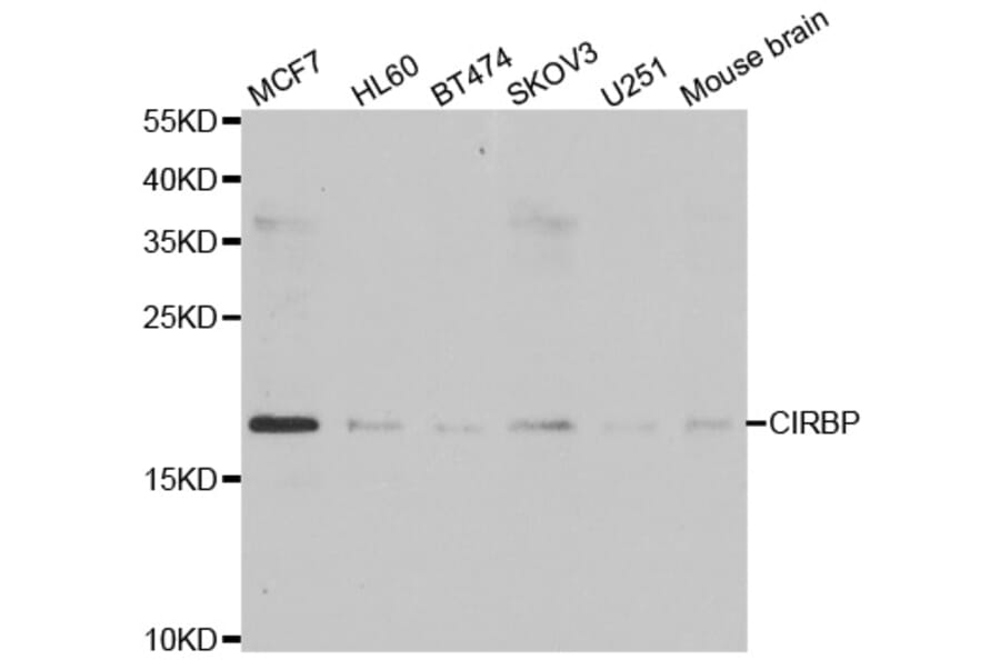 Anti-CIRBP Antibody from Bioworld Technology (BS6943) - Antibodies.com
