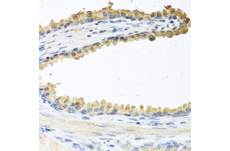 Anti-COCH Antibody from Bioworld Technology (BS6944) - Antibodies.com