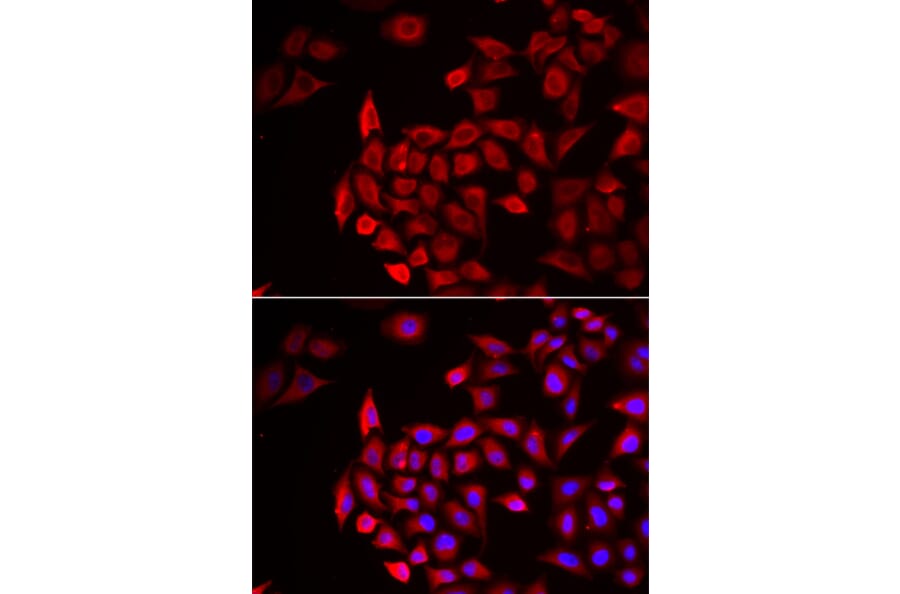 Anti-COCH Antibody from Bioworld Technology (BS6944) - Antibodies.com