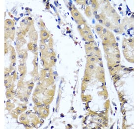 Anti-COL9A1 Antibody from Bioworld Technology (BS6945) - Antibodies.com