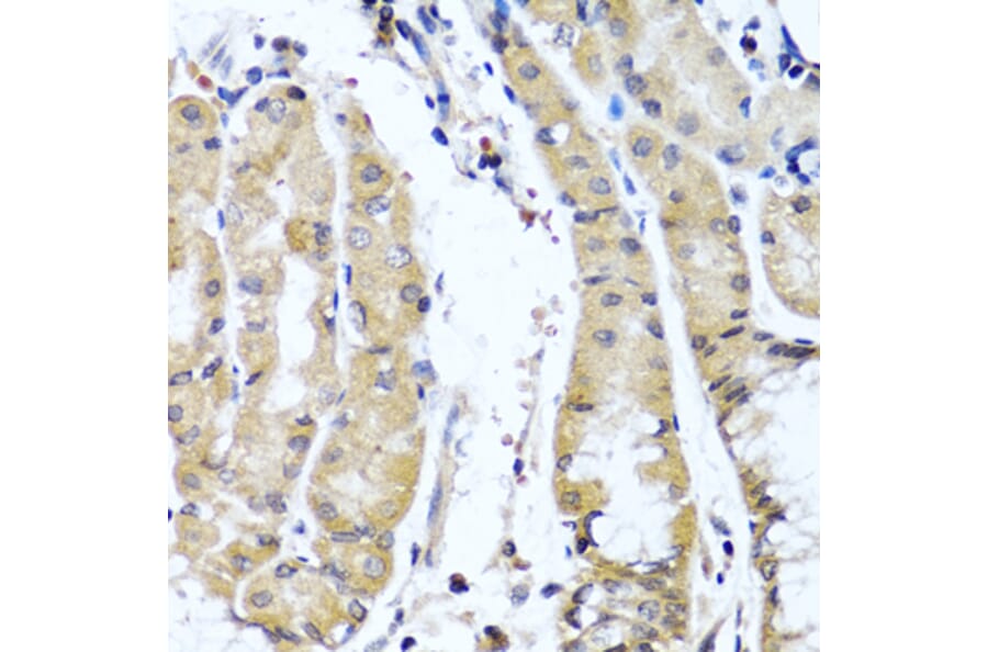 Anti-COL9A1 Antibody from Bioworld Technology (BS6945) - Antibodies.com
