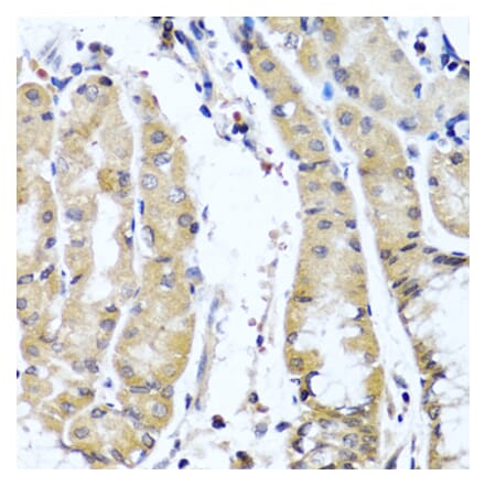 Anti-COL9A1 Antibody from Bioworld Technology (BS6945) - Antibodies.com