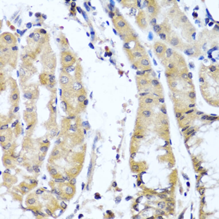 Anti-COL9A1 Antibody from Bioworld Technology (BS6945) - Antibodies.com