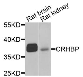 Anti-CRHBP Antibody from Bioworld Technology (BS6948) - Antibodies.com