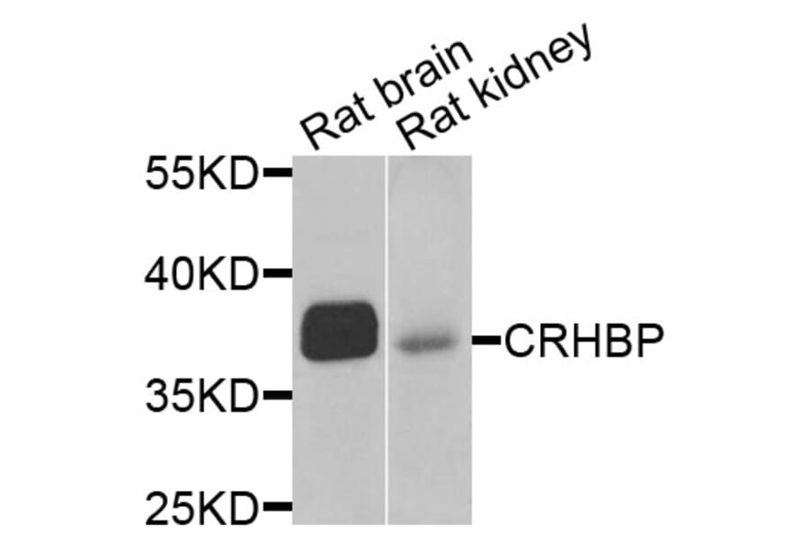 Anti-CRHBP Antibody from Bioworld Technology (BS6948) - Antibodies.com