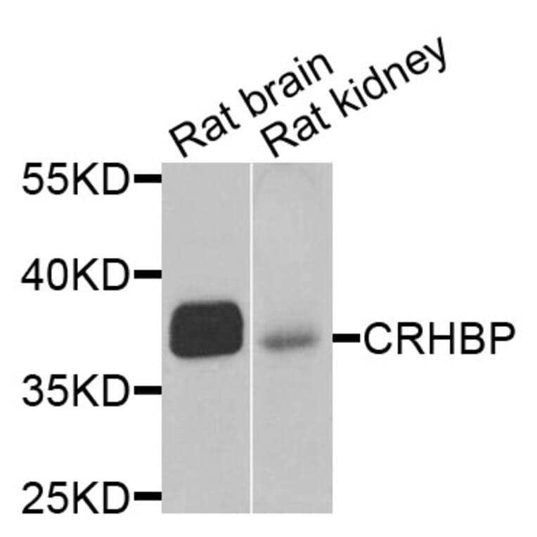 Anti-CRHBP Antibody from Bioworld Technology (BS6948) - Antibodies.com