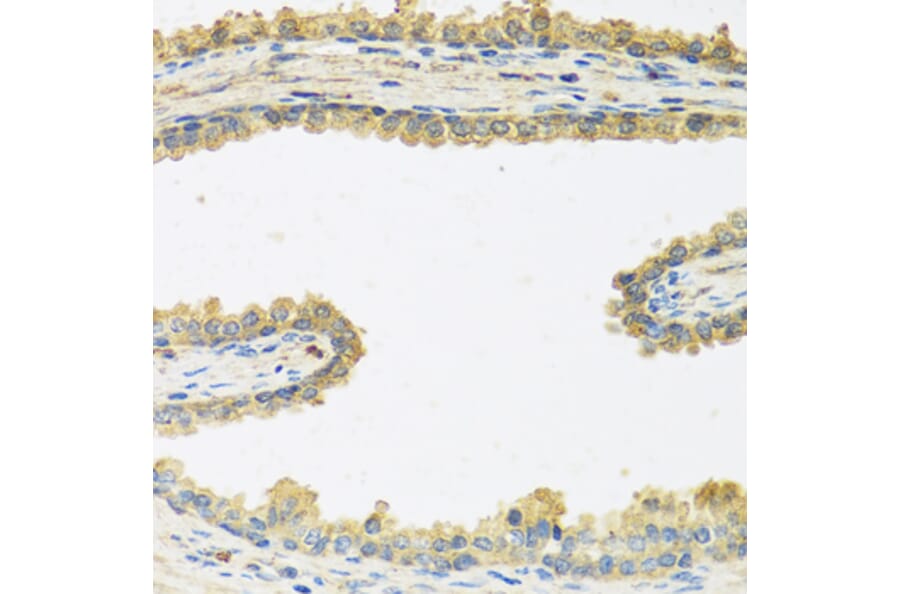 Anti-CRHBP Antibody from Bioworld Technology (BS6948) - Antibodies.com
