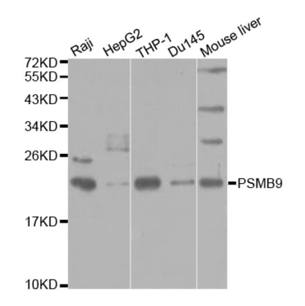 Anti-PSMB9 Antibody from Bioworld Technology (BS6954) - Antibodies.com