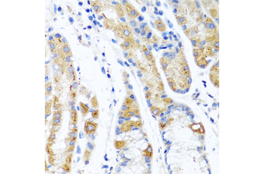 Anti-CST1 Antibody from Bioworld Technology (BS6955) - Antibodies.com