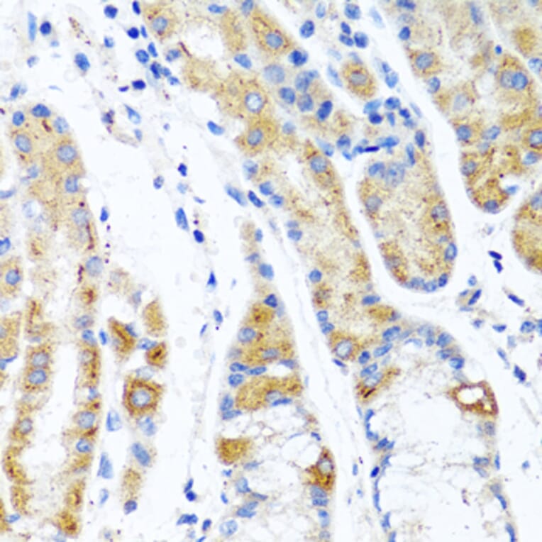 Anti-CST1 Antibody from Bioworld Technology (BS6955) - Antibodies.com