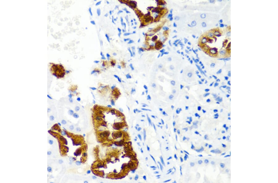 Anti-CST1 Antibody from Bioworld Technology (BS6955) - Antibodies.com