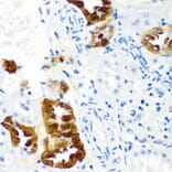 Anti-CST1 Antibody from Bioworld Technology (BS6955) - Antibodies.com