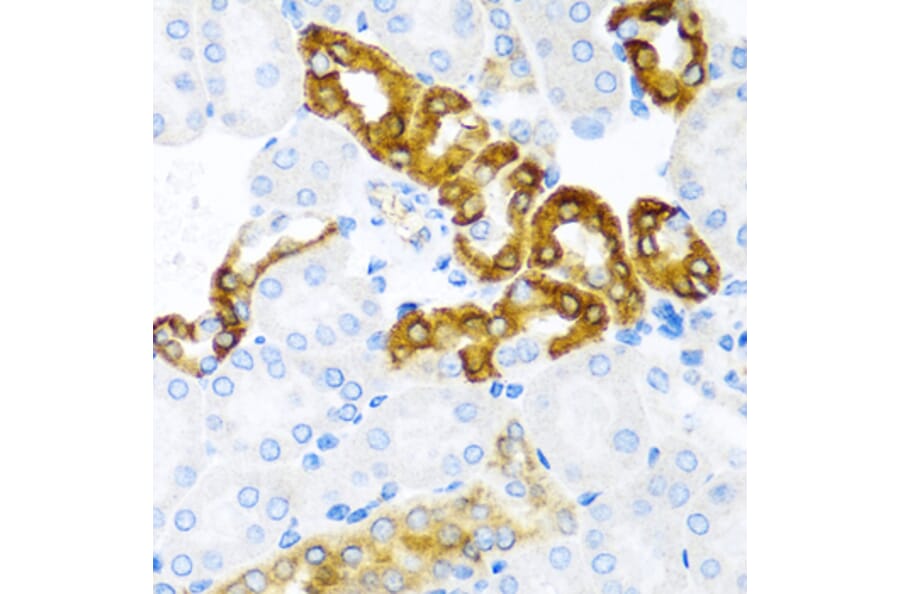 Anti-CST1 Antibody from Bioworld Technology (BS6955) - Antibodies.com