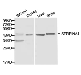 Anti-SERPINA1 Antibody from Bioworld Technology (BS6957) - Antibodies.com
