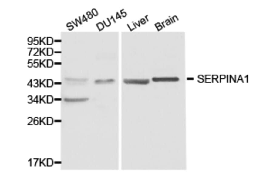 Anti-SERPINA1 Antibody from Bioworld Technology (BS6957) - Antibodies.com