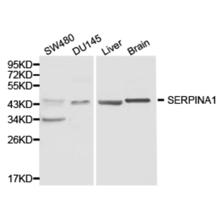 Anti-SERPINA1 Antibody from Bioworld Technology (BS6957) - Antibodies.com