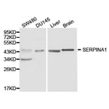 Anti-SERPINA1 Antibody from Bioworld Technology (BS6957) - Antibodies.com