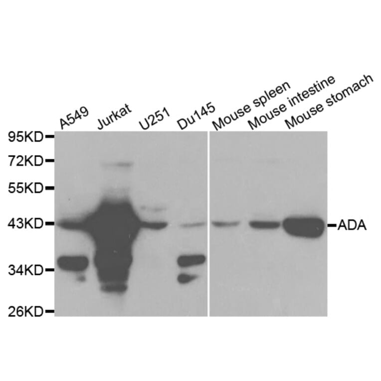 Anti-ADA Antibody from Bioworld Technology (BS6958) - Antibodies.com