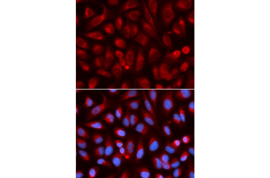 Anti-ADA Antibody from Bioworld Technology (BS6958) - Antibodies.com