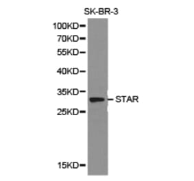 Anti-STAR Antibody from Bioworld Technology (BS6960) - Antibodies.com