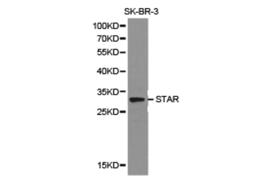 Anti-STAR Antibody from Bioworld Technology (BS6960) - Antibodies.com