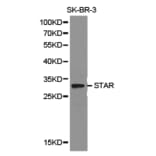 Anti-STAR Antibody from Bioworld Technology (BS6960) - Antibodies.com