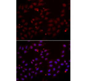 Anti-CST2 Antibody from Bioworld Technology (BS6962) - Antibodies.com