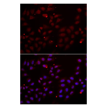 Anti-CST2 Antibody from Bioworld Technology (BS6962) - Antibodies.com
