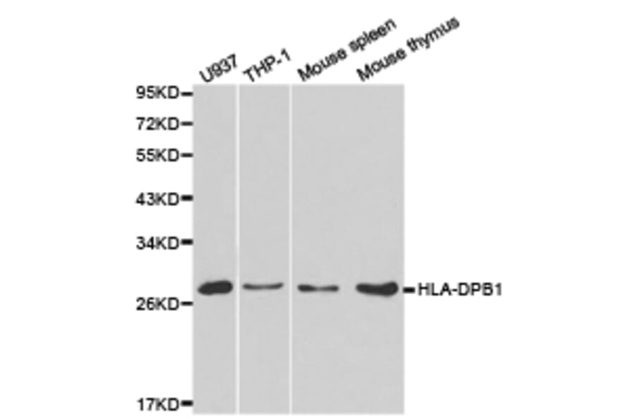 Anti-HLA-DPB1 Antibody from Bioworld Technology (BS6964) - Antibodies.com