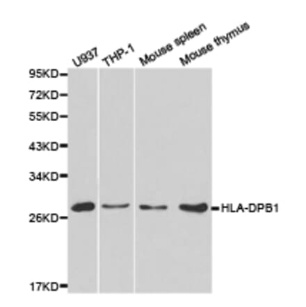 Anti-HLA-DPB1 Antibody from Bioworld Technology (BS6964) - Antibodies.com