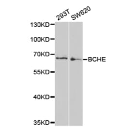 Anti-BCHE Antibody from Bioworld Technology (BS6965) - Antibodies.com