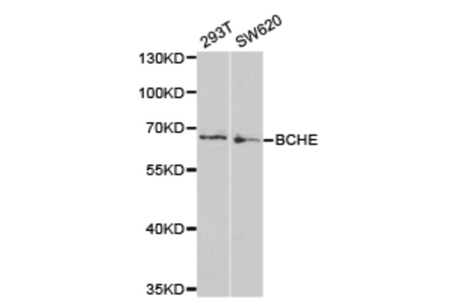 Anti-BCHE Antibody from Bioworld Technology (BS6965) - Antibodies.com