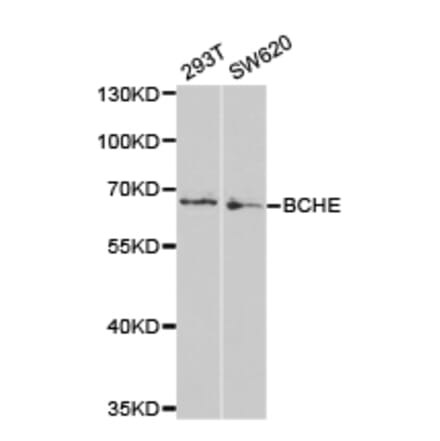 Anti-BCHE Antibody from Bioworld Technology (BS6965) - Antibodies.com