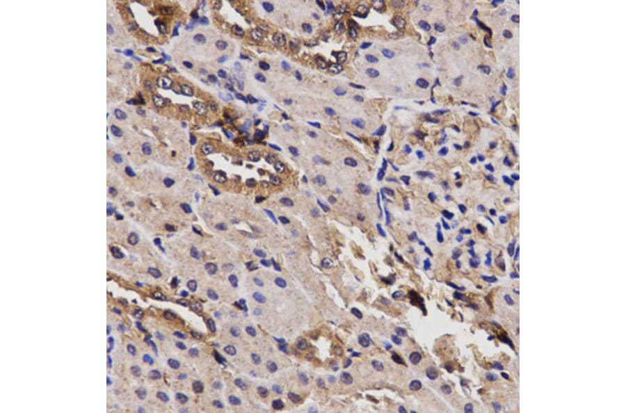 Anti-BCHE Antibody from Bioworld Technology (BS6965) - Antibodies.com