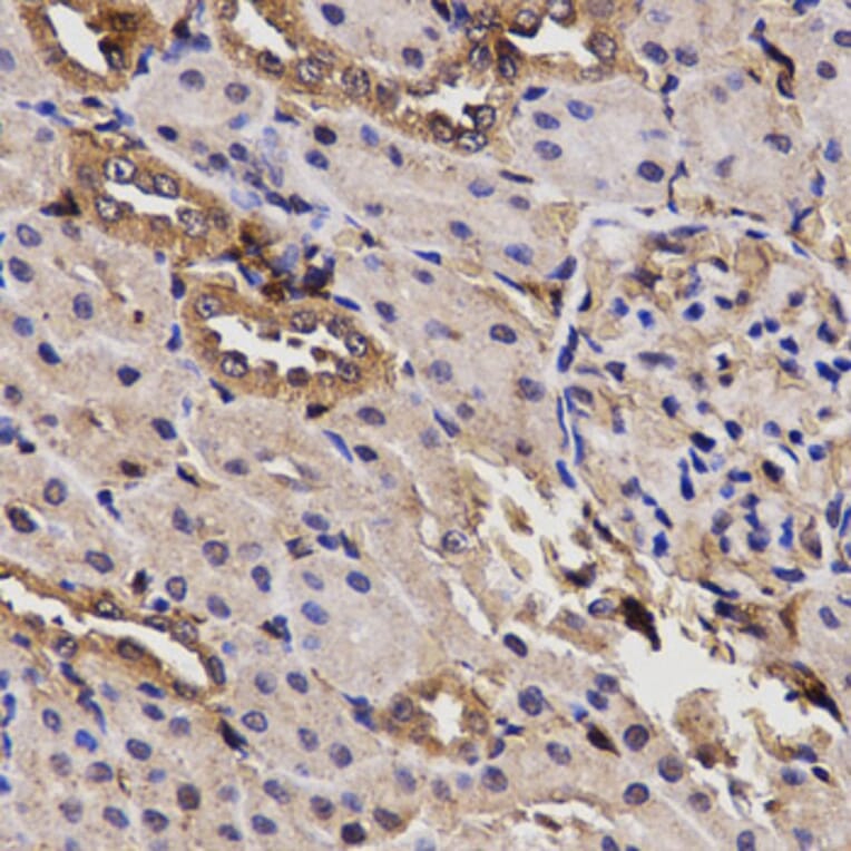 Anti-BCHE Antibody from Bioworld Technology (BS6965) - Antibodies.com