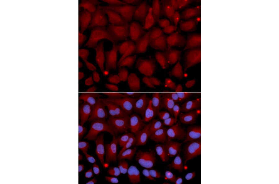 Anti-BCHE Antibody from Bioworld Technology (BS6965) - Antibodies.com
