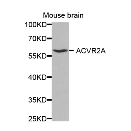 Anti-ACTR-IIA Antibody from Bioworld Technology (BS6967) - Antibodies.com
