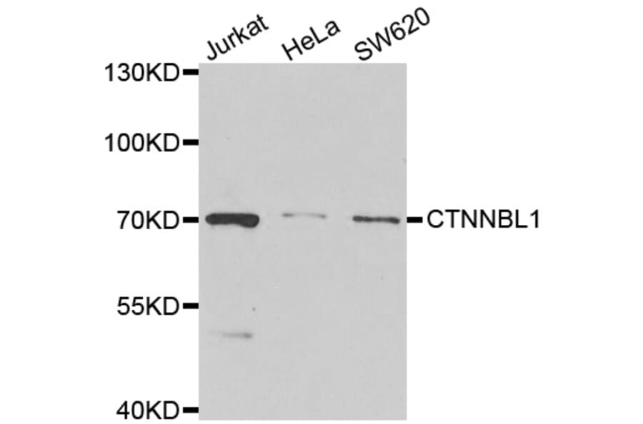 Anti-CTNNBL1 Antibody from Bioworld Technology (BS6972) - Antibodies.com