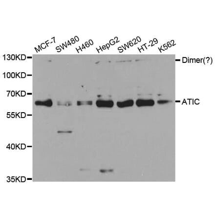 Anti-ATIC Antibody from Bioworld Technology (BS6973) - Antibodies.com