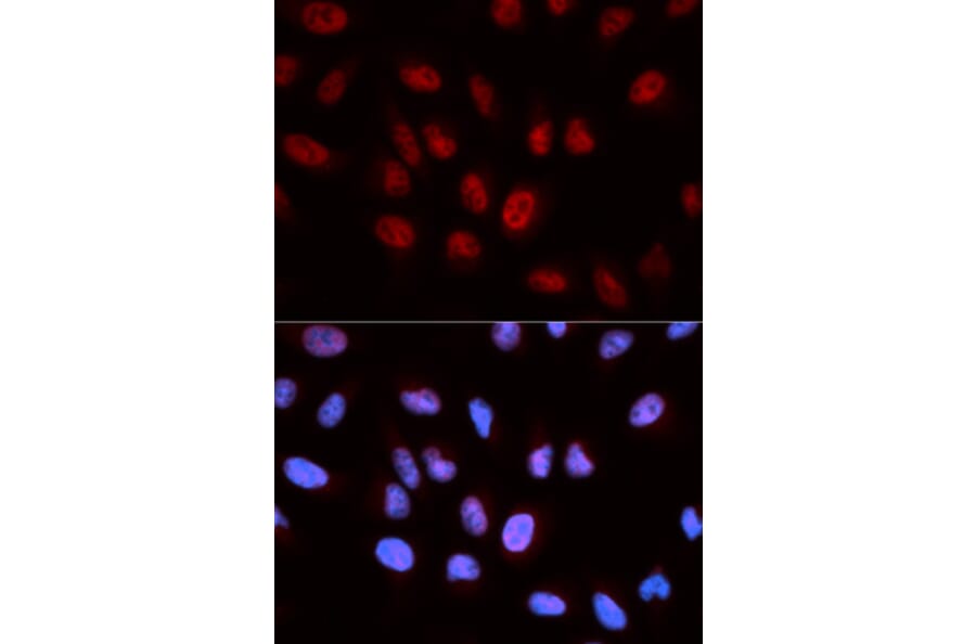 Anti-ATIC Antibody from Bioworld Technology (BS6973) - Antibodies.com