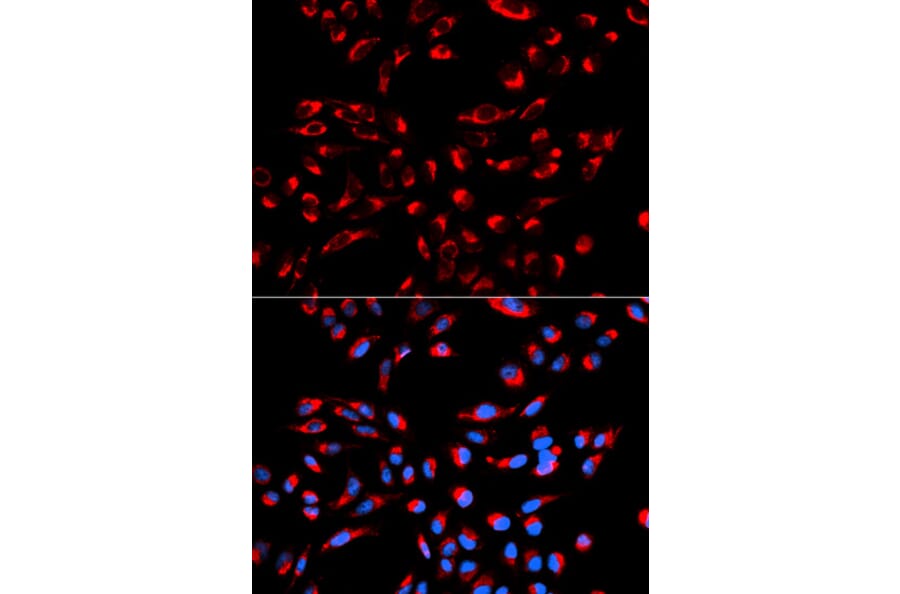 Anti-C1QBP Antibody from Bioworld Technology (BS6975) - Antibodies.com
