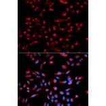 Anti-C1QBP Antibody from Bioworld Technology (BS6975) - Antibodies.com