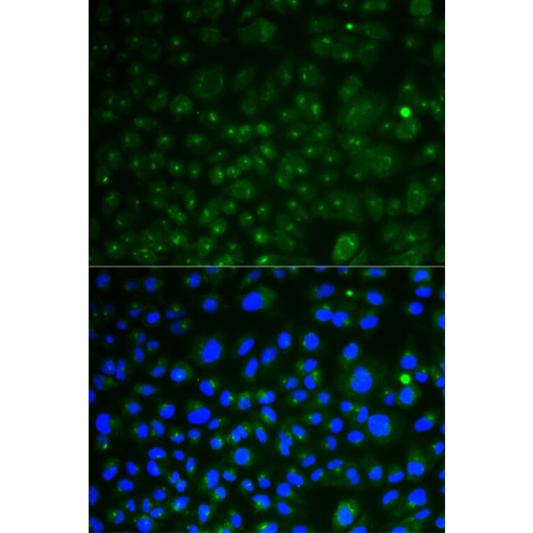 Anti-CD107a Antibody from Bioworld Technology (BS6978) - Antibodies.com