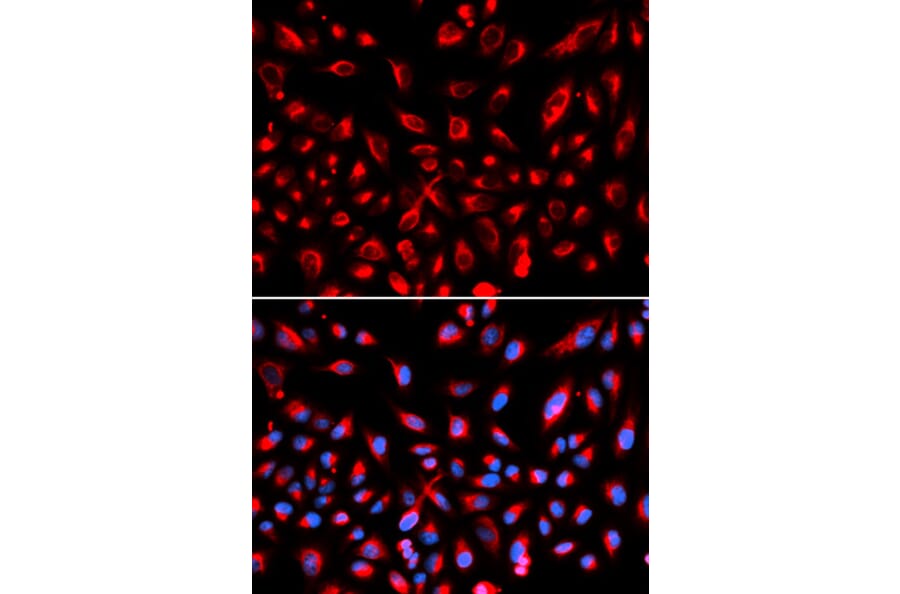 Anti-Claudin-11 Antibody from Bioworld Technology (BS6986) - Antibodies.com