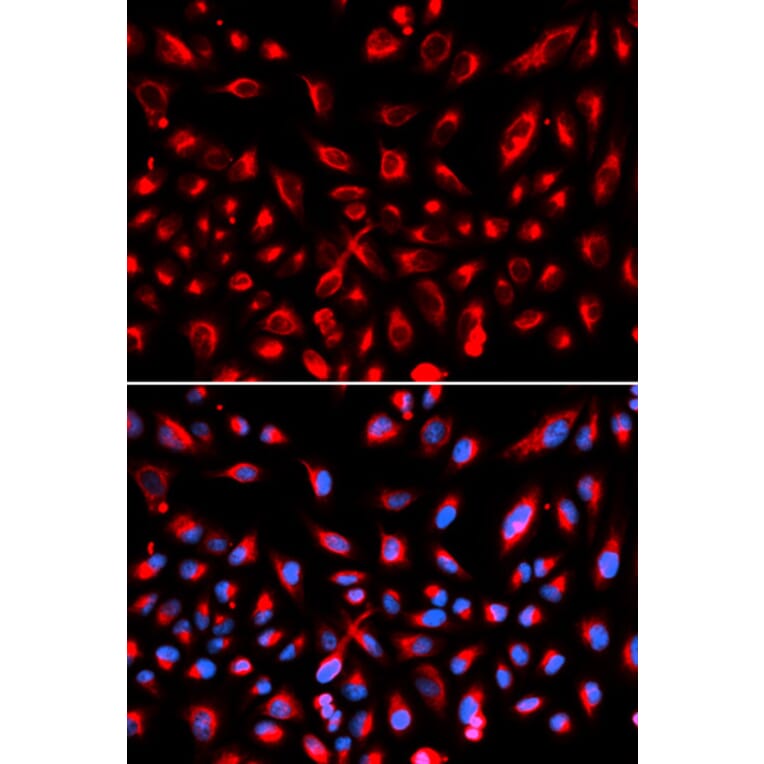 Anti-Claudin-11 Antibody from Bioworld Technology (BS6986) - Antibodies.com