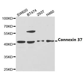 Anti-Connexin 37 Antibody from Bioworld Technology (BS6988) - Antibodies.com